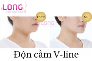 nguoi-mat-tron-don-cam-vline-co-duoc-khong-1