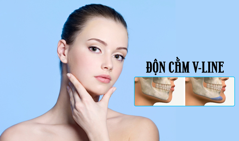 độn cằm bằng mỡ tự thân