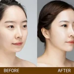 bác sĩ độn cằm đẹp quận 10 tphcm