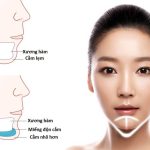 độn cằm có vĩnh viễn không