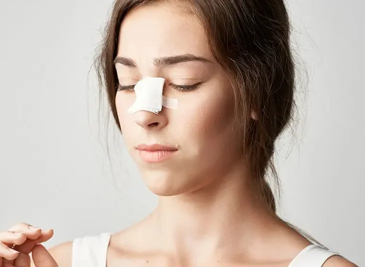Nâng sống mũi bị sưng bao lâu thì lành