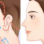 Phẫu thuật căng da mặt giữ được bao lâu và cách duy trì lâu nhất