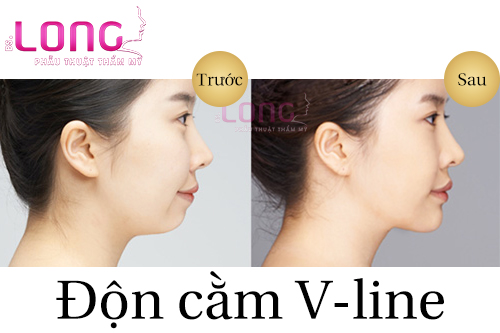 don-cam-vline-danh-cho-doi-tuong-nao-1