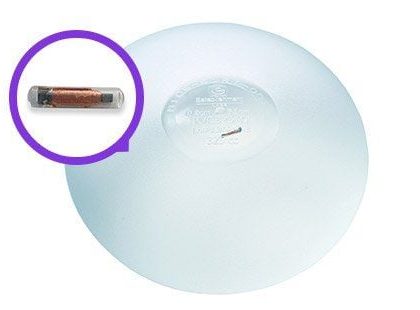 nâng ngực nano chip