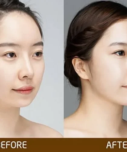 bác sĩ độn cằm đẹp quận 10 tphcm