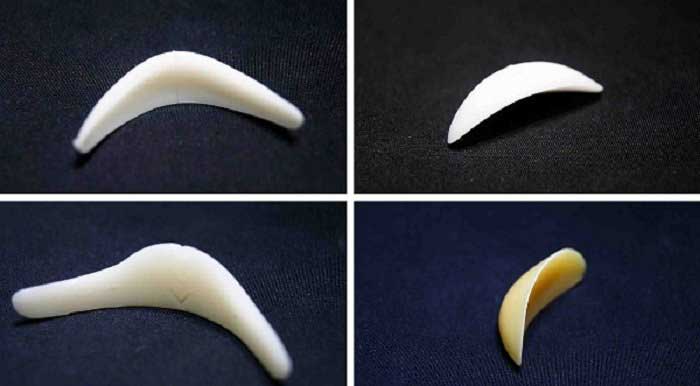 sụn độn cằm