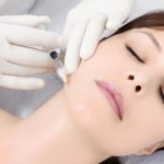 độn cằm bằng mỡ tự thân có được không