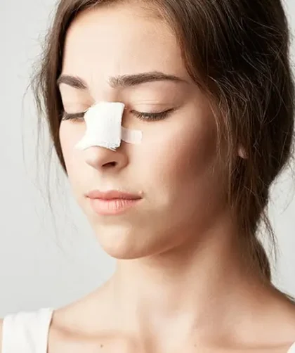 Nâng sống mũi bị sưng bao lâu thì lành